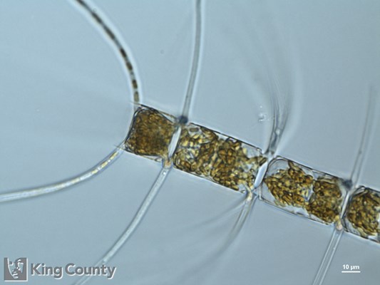 Photo of Chaetoceros eibenii